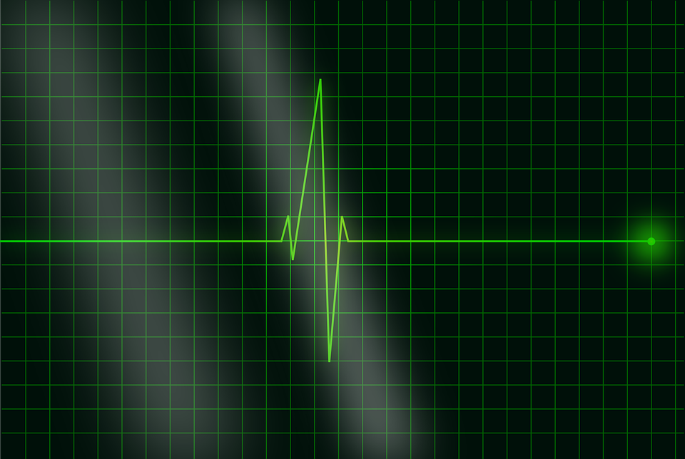 signal processing